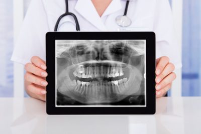 Radiografia dentista Malo vicenza